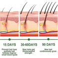thumbnail image 4 of Rosemary Hair Oil For Hair Growth, Essential Oil, Strengthens Hair, Nourishes Scalp, Premium Therapeutic Grade With Dropper, 4 of 5