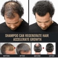 thumbnail image 5 of Root Activator Shampoo, Mane Root Activator Shampoo, Shampoo Root Activator Promotes Hair Growth For Men Hair Thickening Shampoo - Pjun, 5 of 5