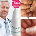 thumbnail image 5 of Cuidado De Los Pies Antihongos 10ml Cuidado De Los Pies Antihongos Eliminación De Hongos Infección Máxima Fuerza Herbal Pie Hongos Reparación Tratamiento De Uñas ANGGREK No, 5 of 5