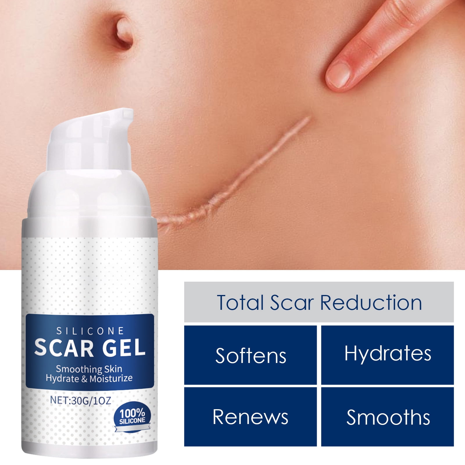 Alvantor Silicone Scar Gel for C-Section, Stretch Marks, Acne, and Surgery Scars