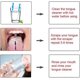 thumbnail image 3 of KAIYANG Raspador de acero inoxidable, limpiador de lengua con caja de almacenamiento que combate el mal aliento para el cuidado bucal, 3 of 5