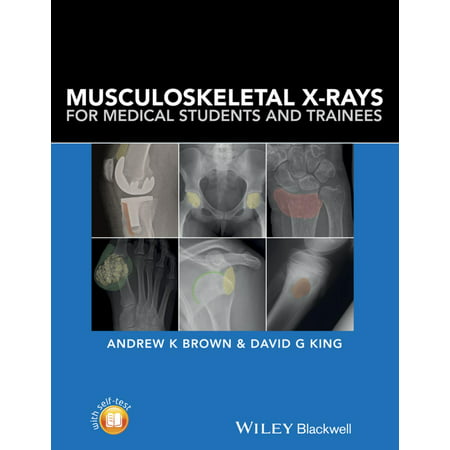 Musculoskeletal X-Rays for Medical Students and Trainees -