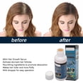 thumbnail image 3 of Suero para el Crecimiento del Cabello ANGGREK 60 ml Hidratante, 3 of 8
