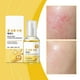 thumbnail image 4 of Hydrating Essence 50ml - Suero exfoliante, iluminador e hidratante con avena y granada - Cuidado de la piel antienvejecimiento para pieles secas y sensibles - Reduce la opacidad y las líneas finas, 4 of 8