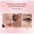 thumbnail image 4 of Anua Peach 70 Niacinamide Face Serum Brightening Essence Moisturizing and Anti-aging Daily Skincare Beauty Products, 4 of 5