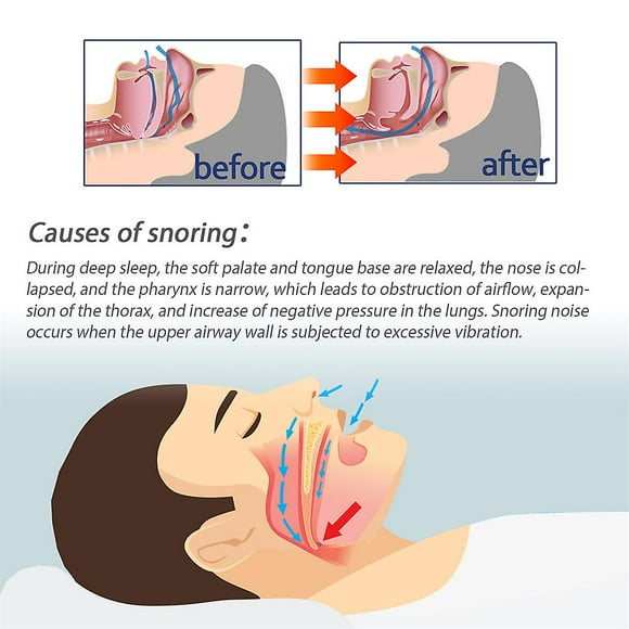 2pcs Snoring Nasal Spray Snore Stopper Drop Reef Remedy Anti Snoring Nose Breathing