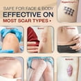 thumbnail image 6 of Ebanel Silicone Scar Gel with Allantoin, Emu Oil, Vitamin E and Onion Extract, For Old & New Scars from Surgeries, C-Section, Injuries, Burns & More, 6 of 8