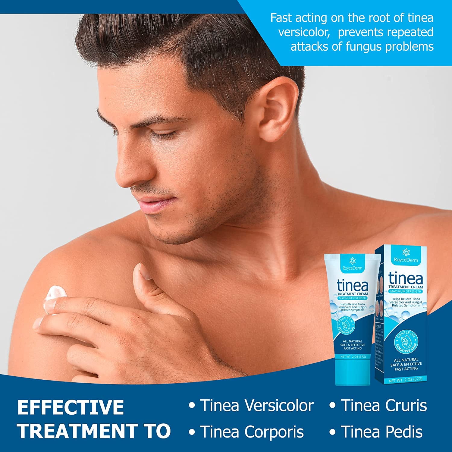 Roycederm Tinea Versicolor Treatment, Athletes Foot Treatment, Ringworm Treatment for Humans, for Tinea Versicolor & Pedis,Fast Healing Anti Fungal Skin Cream
