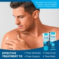 thumbnail image 4 of Roycederm Tinea Versicolor Treatment, Athletes Foot Treatment, Ringworm Treatment for Humans, for Tinea Versicolor & Pedis,Fast Healing Anti Fungal Skin Cream, 4 of 8