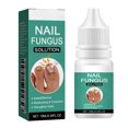 thumbnail image 1 of Anti Nail-Fungus Liquid for Grey Nails Uneven Colors Nail, Quick Absorption Nail Strengthening Cream, Nails Care Supplies, 1 of 5