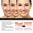 thumbnail image 4 of Aceite de rosa mosqueta Natural, suero facial para masaje, aceite esencial de colágeno, hidratante y Antienvejecimiento para mujeres y hombres, cuidado facial, 4 of 5