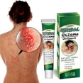 thumbnail image 2 of Ungüento para el tratamiento de la Psoriasis, crema para el cuidado de la piel, 2 of 5