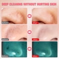 thumbnail image 4 of Blackhead Removal Pore Vacuum Cleaner - LED Screen and USB Rechargeable Facial P, 4 of 5