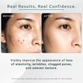 thumbnail image 3 of Olive Derived Squalane 5% + Hyaluronic Acid 2% + Vitamin E – Advanced Hydrating & Anti-Aging Face Serum – Restores Elasticity, Smooths Fine Lines – Lightweight Moisture for All Skin Types 1fl .oz, 3 of 10