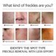 thumbnail image 5 of 1pc Jaysuing Anti-dark Spot Facial Essence Fades Spots And Spots Brightens Skin Tone To Remove Melanin Moisturizing Essence |, 5 of 5