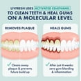thumbnail image 2 of LIVFRESH Dental Gel by Livionex - Clinically Proven to Remove Plaque 250% Better (Foaming + Wintergreen + Blue Gel), 2 of 8