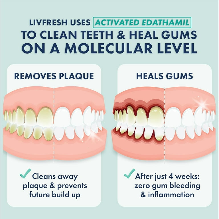 LIVFRESH Dental Gel by Livionex - Removes Plaque 250% Better