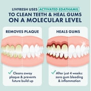 LIVFRESH Dental Gel by Livionex - Clinically Proven to Remove Plaque 250% Better (Foaming + Wintergreen + Blue Gel)