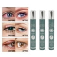 thumbnail image 1 of Vision Enhance Massage Roller, 3pcs Acupressure Gentle Vision Enhance Roller  for Home, 1 of 8