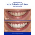 thumbnail image 2 of Acelerador blanqueador Supersmile Professional 100 ml, 2 of 7