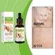 thumbnail image 2 of Aceite esencial para varices, aceite para masajes, venas azules y rojas, aceites esenciales para masajes de varices, 30 ml (compre 2 y ahorre un 10 %), 2 of 7