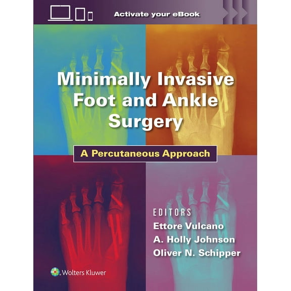 Minimally Invasive Foot and Ankle Surgery: A Percutaneous Approach, (Hardcover)