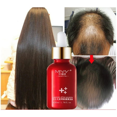 Hair Growth Essence Advanced Thinning Hair & Hair Loss Supplement