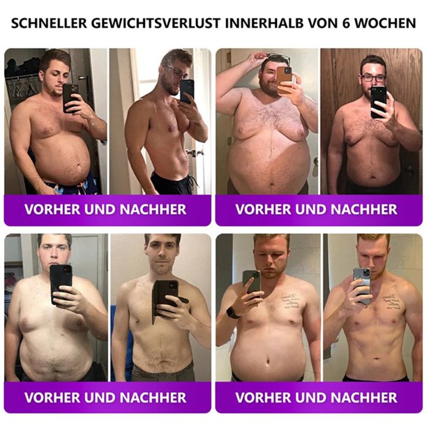 tirzepatide for alzheimer's patients Study sees potential benefits of obesity drug tirzepatide in tackling type 2 diabetes tirzepatide for alzheimer's patients Study sees potential benefits of obesity drug tirzepatide in tackling type 2 diabetes