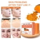 thumbnail image 5 of Jabón de Cúrcuma, Gel de Ducha Facial y Corporal, Jabón de Jengibre Hidratante (100 G) | Jabón Limpiador Natural Artesanal para Cabello y Piel | Incluye Un Jabón de 100 G, 5 of 7