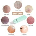thumbnail image 4 of Skin Scrubber MISERWE, espátula facial, limpiador de poros, 4 modos, 4 of 7