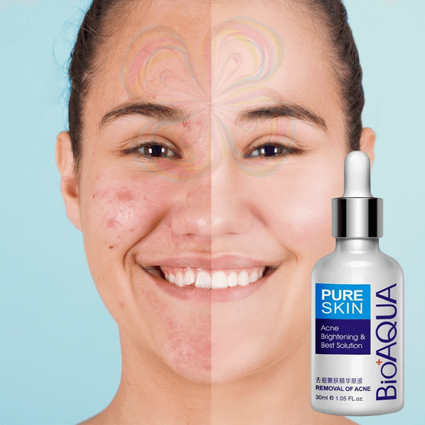 Serum Anti Acné UNIVERSOENLINEA.COM Bioaqua Pure Skin Cuidado Facial 1 Pieza | Walmart en línea