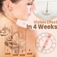 thumbnail image 1 of Fiudx Crema Removedora de Tatuajes, Eliminador de Pigmentos de Acción Rápida, Fórmula con Ingredientes Naturales, Tratamiento Hidratante para La Piel, Eliminación Eficaz de Tatuajes, Todo Tipo de Pie, 1 of 6
