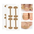 thumbnail image 3 of opvise 1 Set Ingrown Toenail Treatment Breathable No Glue Patch Strips Painless Professional Nail Adjuster Pedicure Tool Toenail Correction Khaki, 3 of 7