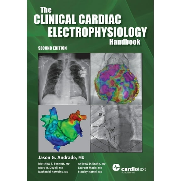 The Clinical Cardiac Electrophysiology Handbook, Second Edition, (Paperback)