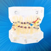 Dental Orthodontic Treatment Malocclusion Study Teeth Model With Wire Chain