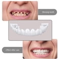 thumbnail image 5 of Parches moldeables, modelo de diente, protector bucal, herramienta de blanqueamiento, aparatos de ortodoncia, juego de bandejas termoformadas, gel blanqueador, blanqueamiento de dientes, A1581, 5 of 5