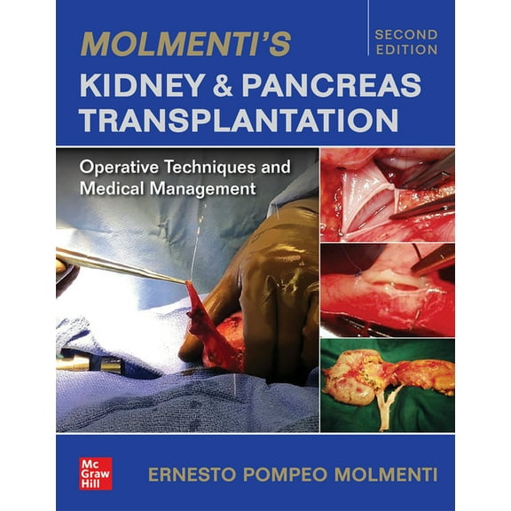 Molmenti's Kidney and Pancreas Transplantation: Operative Techniques and Medical Management (Hardcover)