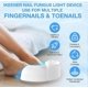 thumbnail image 2 of Welnax BioClear Welnax Nail Fungus Light Mother's Day Gift, 2 of 5