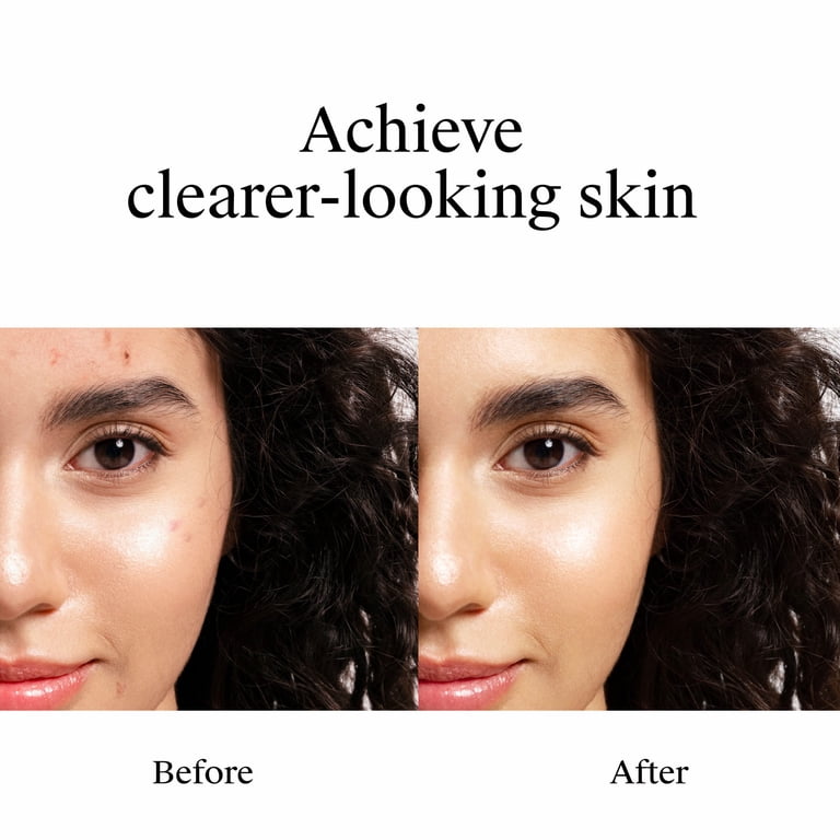 Neutrogena Rapid Clear Acne Spot Treatment, 10% Benzoyl Peroxide photo 3