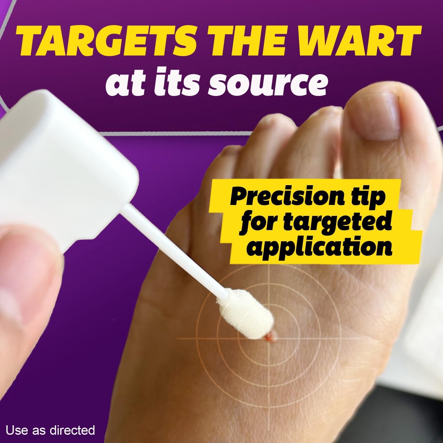Silka Pointts Freeze Off Wart Remover for Common & Plantar Warts, 12 Applicators, Pack of 2