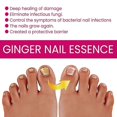 thumbnail image 5 of Ginger Nail Treatment - Nail Fungus Removal, Nail Fungus Treatment for Toenail Strengthens and Smooths Cracked Nail Surface, Ginger Nail Essence Repai, 5 of 5