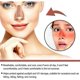 thumbnail image 3 of 24pcs Sun Protection Nose Patch Uv Protection Nose Cover Sports Outdoor Skin-friendly Sun Nose Sticker, 3 of 5
