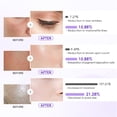thumbnail image 4 of Mascarilla facial YUOLITA Deep Collagen Jelly Gel para piel resplandeciente, 4 of 7