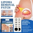 thumbnail image 3 of Parche para el cuidado linfático parche para eliminar bultos de lipoma absorción rápida 24 piezas sin dolor para ateroma ANGGREK Otros, 3 of 8