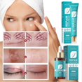 thumbnail image 2 of Scars Repair Cream Effective Acnes Scars Removal Cream For Women Men, 2 of 5