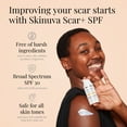 thumbnail image 3 of Skinuva® Scar+ Cream with SPF 30 for Face & Body - Old & New Scar Treatment for Surgery, Burns & Other Skin Trauma (1 oz), 3 of 8