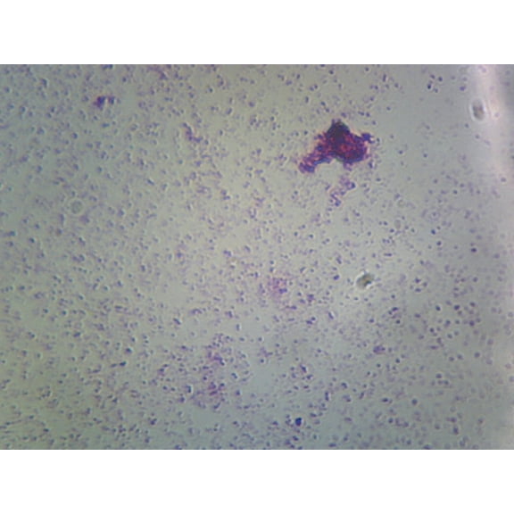 Nitrogen Fixing Bacteria – Azotobacter and Rhizobium Leguminosarum; Smear; Gram-Negative by Go Science Crazy