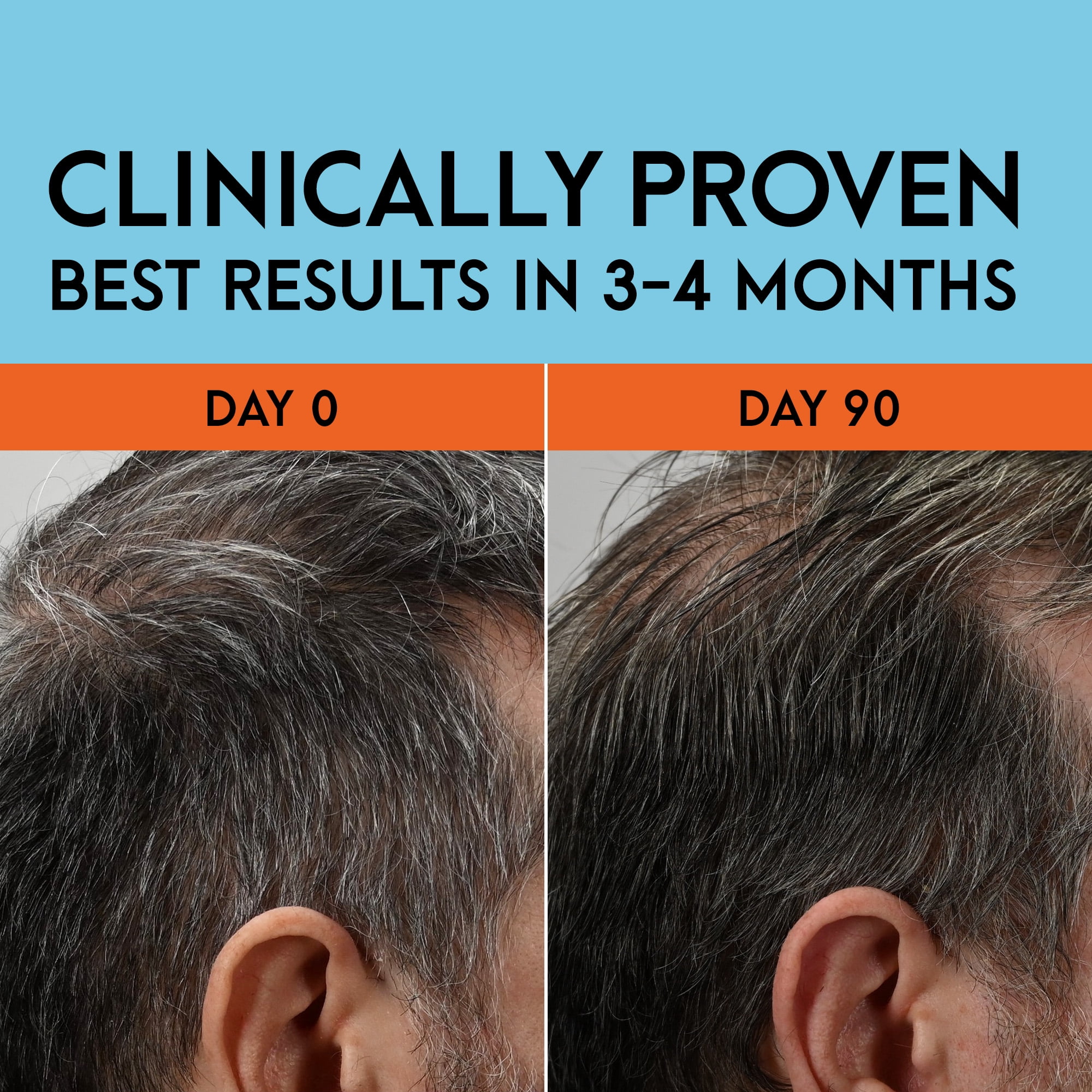 Just for Men Gray Reverse Daily Hair Serum, Gradually Reduces Gray Hair, Easy Dye-Free Serum, Travel Friendly, 1.7oz