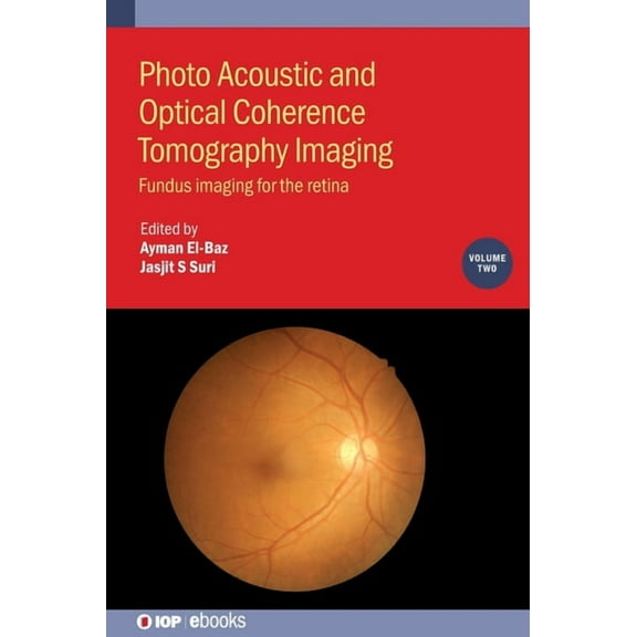 Photo Acoustic and Optical Coherence Tomography Imaging, Volume 2: Fundus imaging for the retina, (Hardcover)