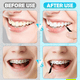 thumbnail image 2 of 120pcs Interdental Brushes, Braces Brush Cleaner for Teeth Cleaning Tools Spiral Dental Brush for Efficient Oral Care B, 2 of 5